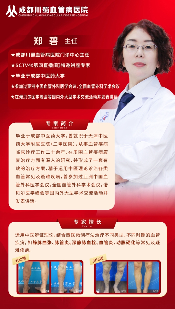 成都川蜀血管病医院郑碧主任：以医术和医德赢得患者赞誉的血管病专家