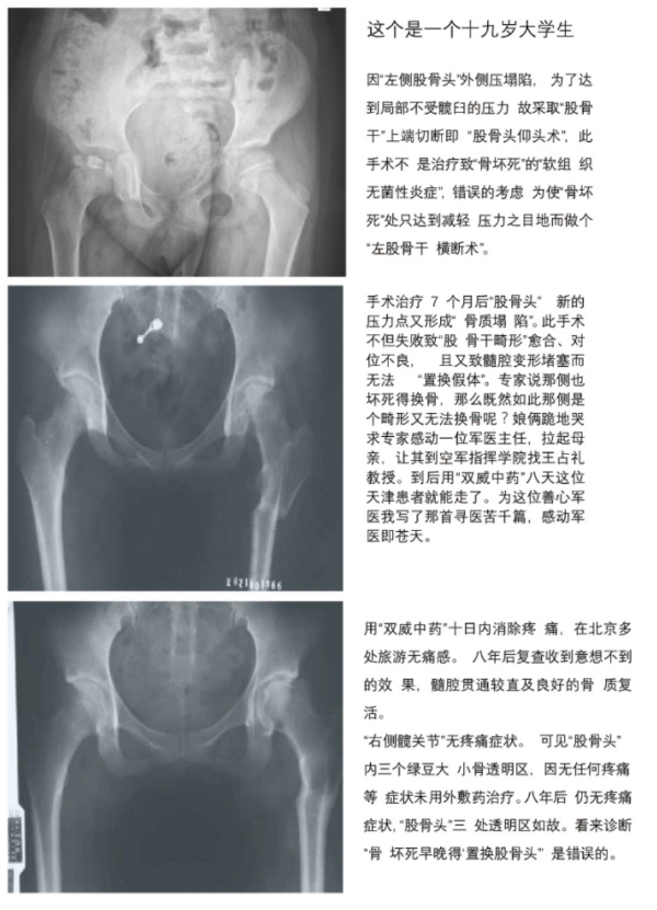 王占礼：向人类医学界及世界人民的 《宣告书》的简介