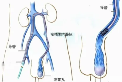 ţΪʲôࣿɶѪר̡֣ҽﻰ