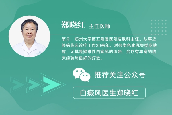 郑州白癜风医院：光疗后如何护理？